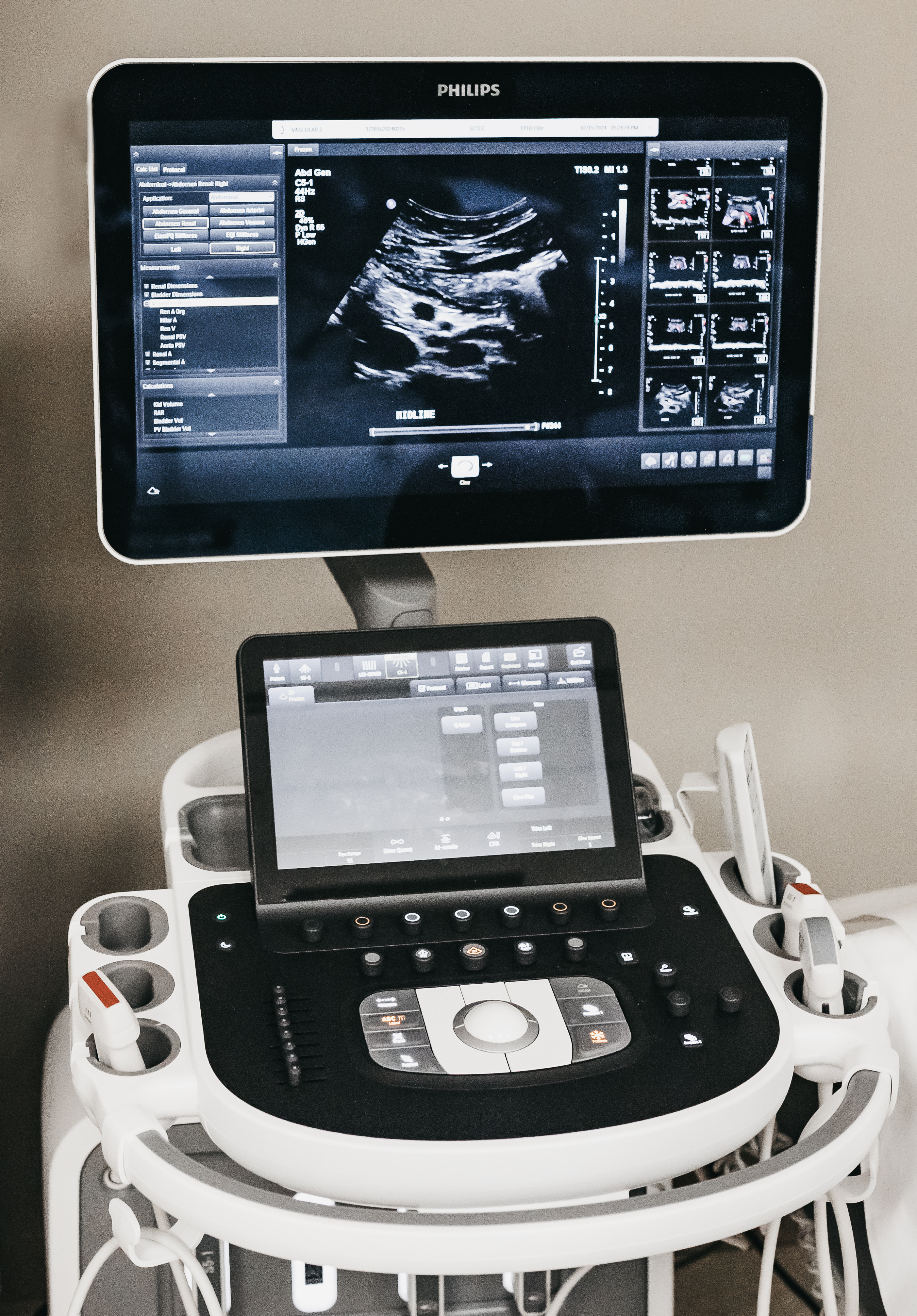 ultrasound machine from above